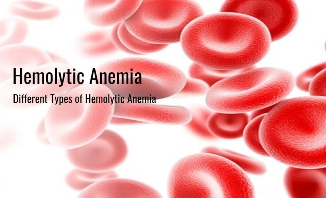 Types of Hemolytic Anemia